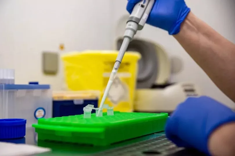 Imagen de una prueba PCR relacionada con hantavirus.