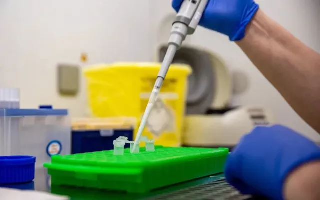 Imagen de una prueba PCR relacionada con hantavirus.