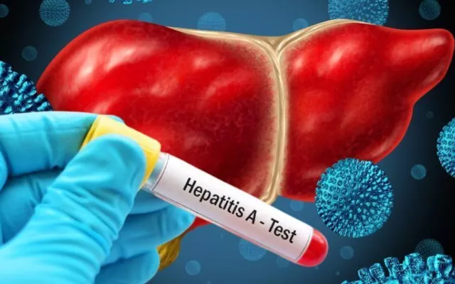 Imagen informativa sobre el incremento de casos de hepatitis A en la provincia de Pinar del Río.